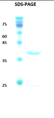 HIV-1 Envelope gp120/gp41 Recombinant Protein