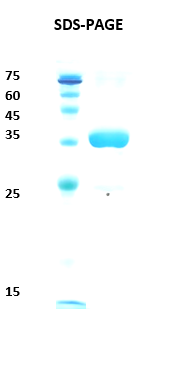 HIV-1 Envelope gp120/gp41 Recombinant Protein