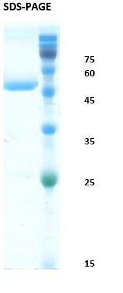 HIV-1 Envelope gp120/gp41 Recombinant Protein