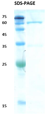 HIV-1 Gag p24 Recombinant Protein