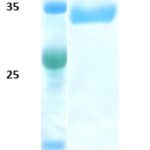 SDS-Page Image