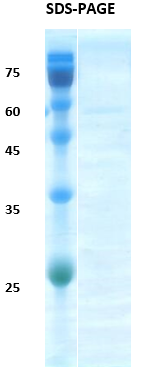 HIV-2 Gag p26 Recombinant Protein