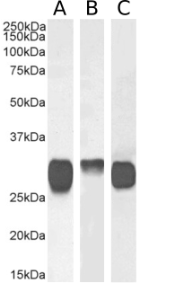 HLA class II Antibody [F3.3], Rabbit IgG