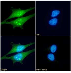 HSPB1 Antibody [SAIC-23B-22], Rabbit IgG