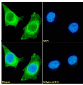 HSPB1 Antibody [SAIC-23E-30], Rabbit IgG