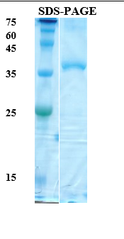 HTLV-2 Envelope gp21 Recombinant Protein