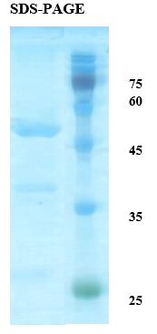HTLV-2 Envelope gp21 Recombinant Protein