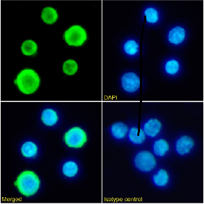 Haemoglobin Antibody [2A1], Rabbit IgG