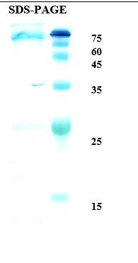 Helicobacter pylori (H. pylori) Catalase (KatA) Recombinant Protein