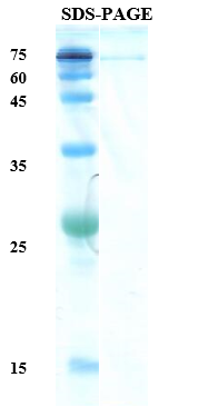 Helicobacter pylori (H. pylori) Catalase (KatA) Recombinant Protein