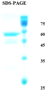 Helicobacter pylori (H. pylori) UreA Recombinant Protein