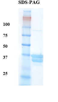 Hemoglobin variant C Recombinant Protein
