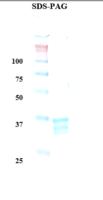 Hemoglobin variant D Recombinant Protein