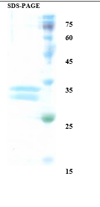 Hemoglobin variant E Recombinant Protein