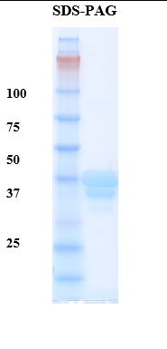 Hemoglobin variant S Recombinant Protein