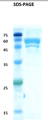 Hepatitis A virus (HAV) chimeric Recombinant Protein
