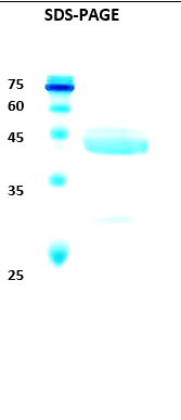 Hepatitis C virus (HCV) NS3 (123AA) Recombinant Protein