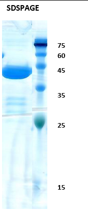 Hepatitis C virus (HCV) NS3 (176AA) Recombinant Protein