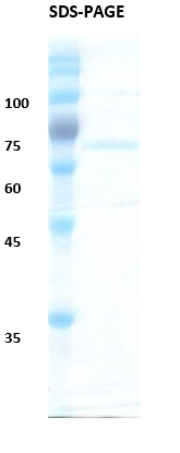 Hepatitis C virus (HCV) NS3 (301AA) Recombinant Protein