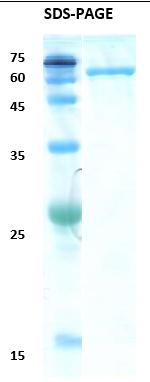 Hepatitis C virus (HCV) NS3 (383AA) Recombinant Protein
