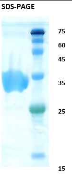 Hepatitis C virus (HCV) NS3 Recombinant Protein