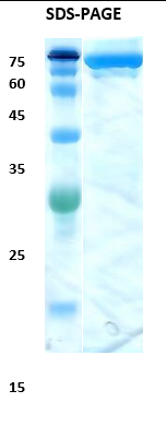 Hepatitis C virus (HCV) core/NS3 Recombinant Protein