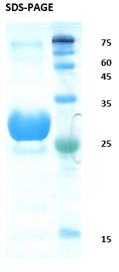 Hepatitis C virus (HCV) core Recombinant Protein