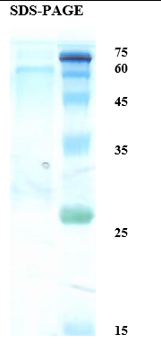 Herpes Simplex Virus Type 1 (HSV-1) Glycoprotein G Recombinant Protein