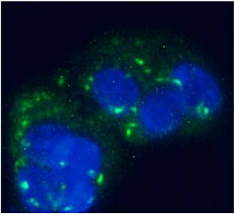 Human Glucagon Receptor Antibody [hGR-2 F6], Mouse IgG1