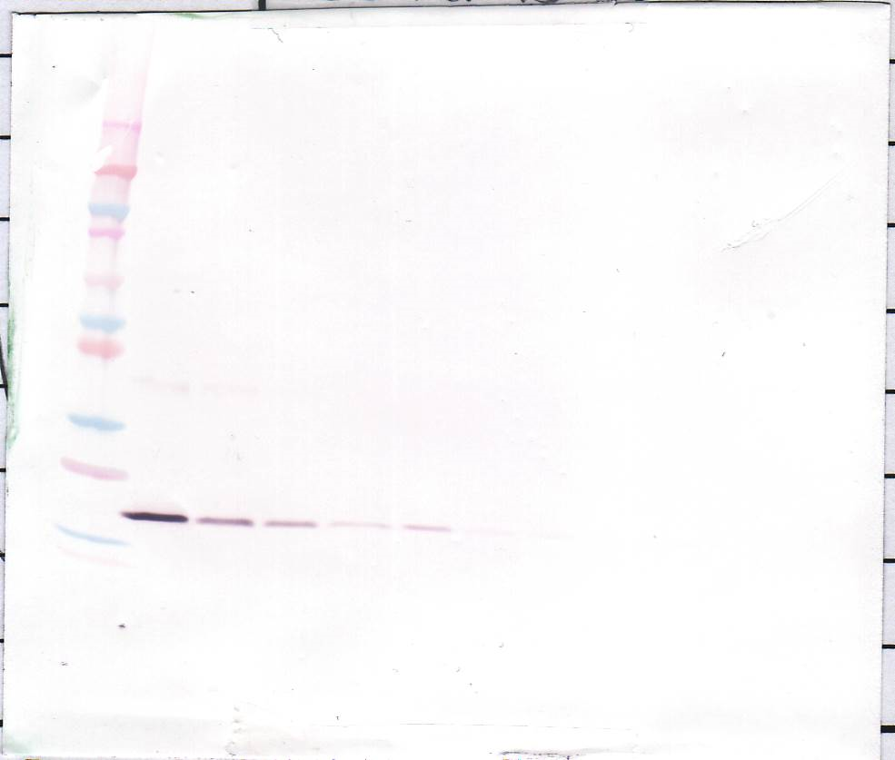 IL-1 beta Antibody