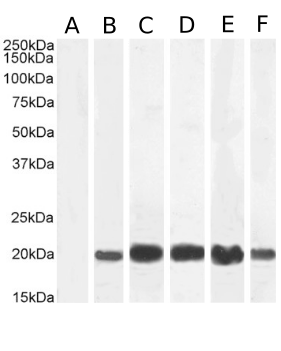 IL-2 Antibody [LNKB-2], Rabbit IgG