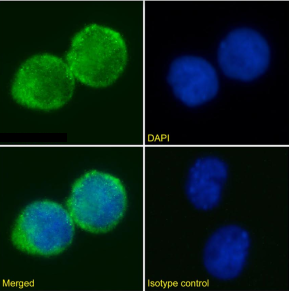 IL2R Antibody [AHT107], Rabbit IgG