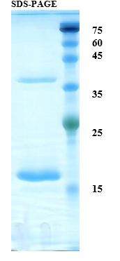 Interleukin 2 Recombinant Protein