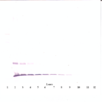 To detect mJE(MCP-1) by Western Blot analysis this antibody can be used at a concentration of 0.1-0.2 ug/ml. Used in conjunction with compatible secondary reagents the detection limit for recombinant mJE(MCP-1) is 1.5-3.0 ng/lane, under either reducing or non-reducing conditions.