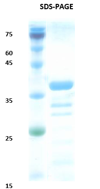 Leishmania K28 Recombinant Protein
