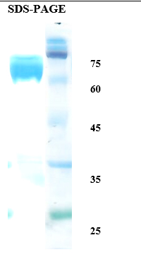 Leishmania K39 Recombinant Protein
