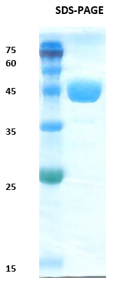 Lymphatic Filariasis SXP-1 Recombinant Protein