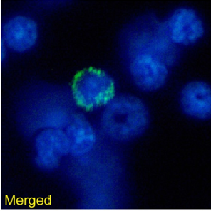 MHC I Antibody [R1-21.2], Rabbit IgG