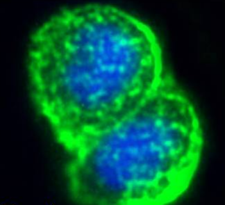 MUC1 Antibody [Mc5], Rabbit IgG