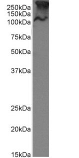 MUC1 Antibody [SM3], Rabbit IgG