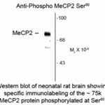 Western blot of neonatal rat brain showing specific immunolabeling of the ~75k MeCP2 protein phosphorylated at Ser80.