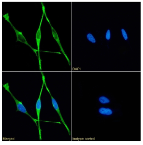Mesothelin Antibody [11-25], Rabbit IgG