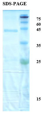 Mycobacterium tuberculosis Antigen 14/16 Chimeric Recombinant Protein