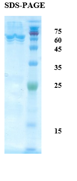 Mycobacterium tuberculosis Antigen 14/16 Chimeric Recombinant Protein