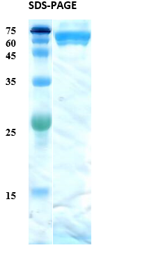Mycobacterium tuberculosis Antigen 38 Recombinant Protein