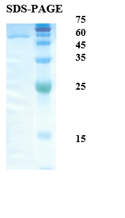 Mycobacterium tuberculosis Major Secretory Antigen 85B Recombinant Protein