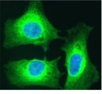 NFKB2 Antibody [SAIC-26C-15], Rabbit IgG