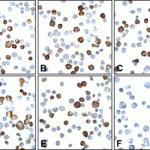 Immunocytochemistry of PD-L2 in overexpressing 293 cells using (A) RF16021, (B) RF16022, (C) RF16023, (D) RF16024, (E) RF16025, and (F) control mouse IgG antibody at 5 μg/ml.