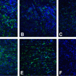 Immunofluorescence of PD-L2 in human tonsil tissue using (A) RF16021, (B) RF16022, (C) RF16023, (D) RF16024, (E) RF16025, and (F) control mouse IgG antibody at 20 μg/ml.