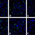 Immunofluorescence of PD-L2 in overexpressing 293 cells using (A) RF16021, (B) RF16022, (C) RF16023, (D) RF16024, (E) RF16025, and (F) control mouse IgG antibody at 20 μg/ml.